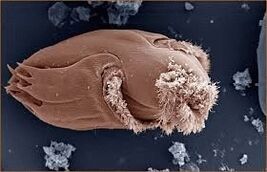 Microorganismos patogênicos em humanos