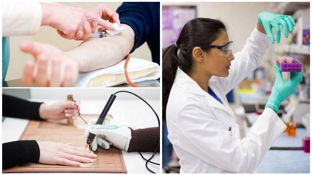 Métodos de diagnóstico para detectar parasitas no corpo